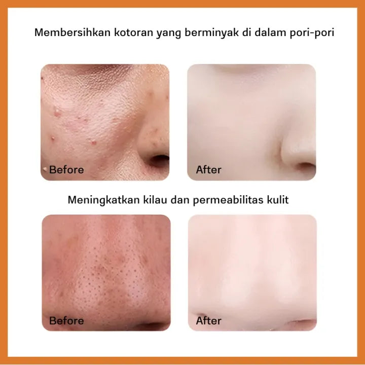 KORMESIC Papaya Exfoliating Scrub Cleanser 100g