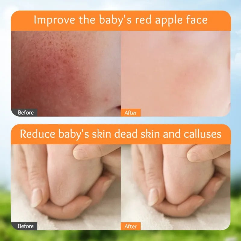 SADOER Calendula Vitamin E Gentle Soothing Baby Anti-Cracking Cream 50g