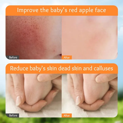 SADOER Calendula Vitamin E Gentle Soothing Baby Anti-Cracking Cream 50g