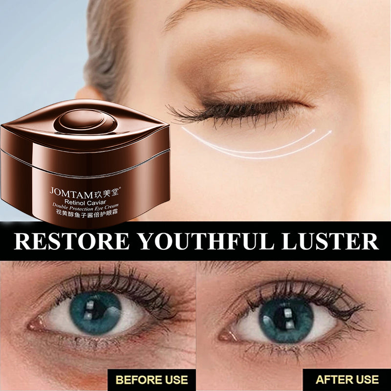 JOMTAM Retinol Caviar Eye Cream Removing Dark Circles Removing Eye Bags cream Anti Aging Removal Wrinkle Cream
