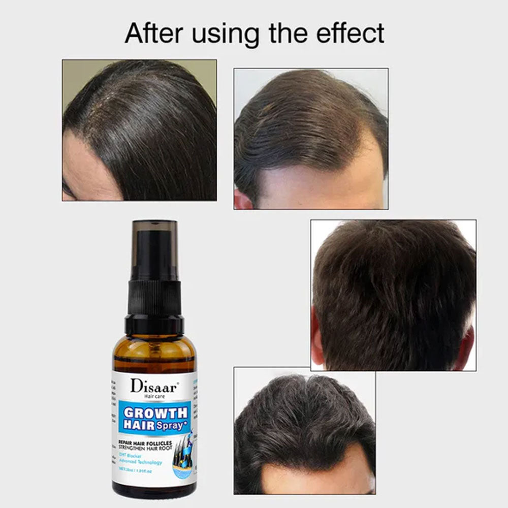 Disaar Hair Growth Strengthen Hair Root Spray – 30ml
