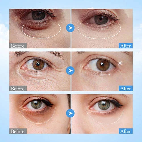 Sadoer Goat Milk Nourish Anti-Wrinkle Eye Mask 60 Pcs
