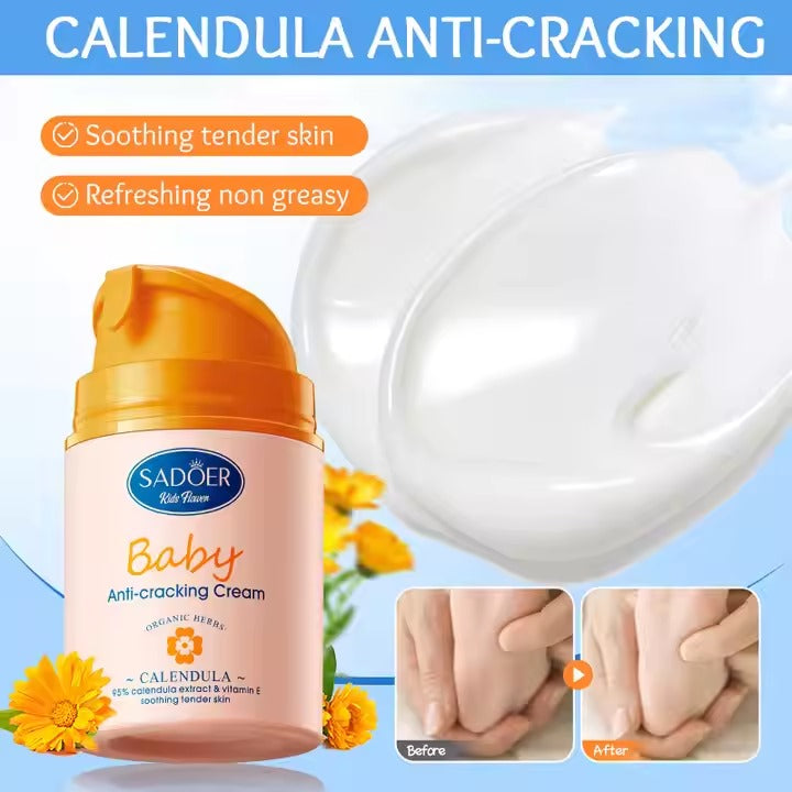SADOER Calendula Vitamin E Gentle Soothing Baby Anti-Cracking Cream 50g