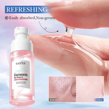 Sadoer 10% Niacinamide Spot Removal Hydrating Serum