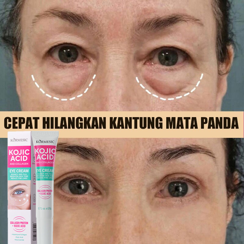 KORMESIC Kojic Acid And Collagen Eye Cream 20g