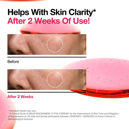 ANUA Niacinamide 10 + TXA 4 Serum 30ml