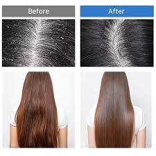 MASIL 5 Probiotics Perfect Volume Shampoo