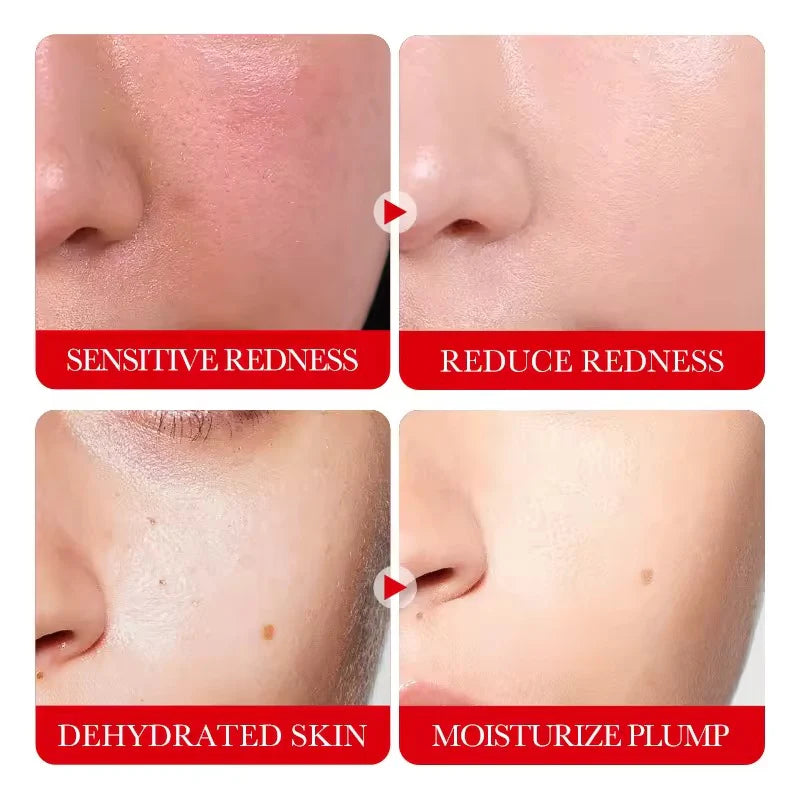 Sadoer Ceramide Soothing Repair Cream