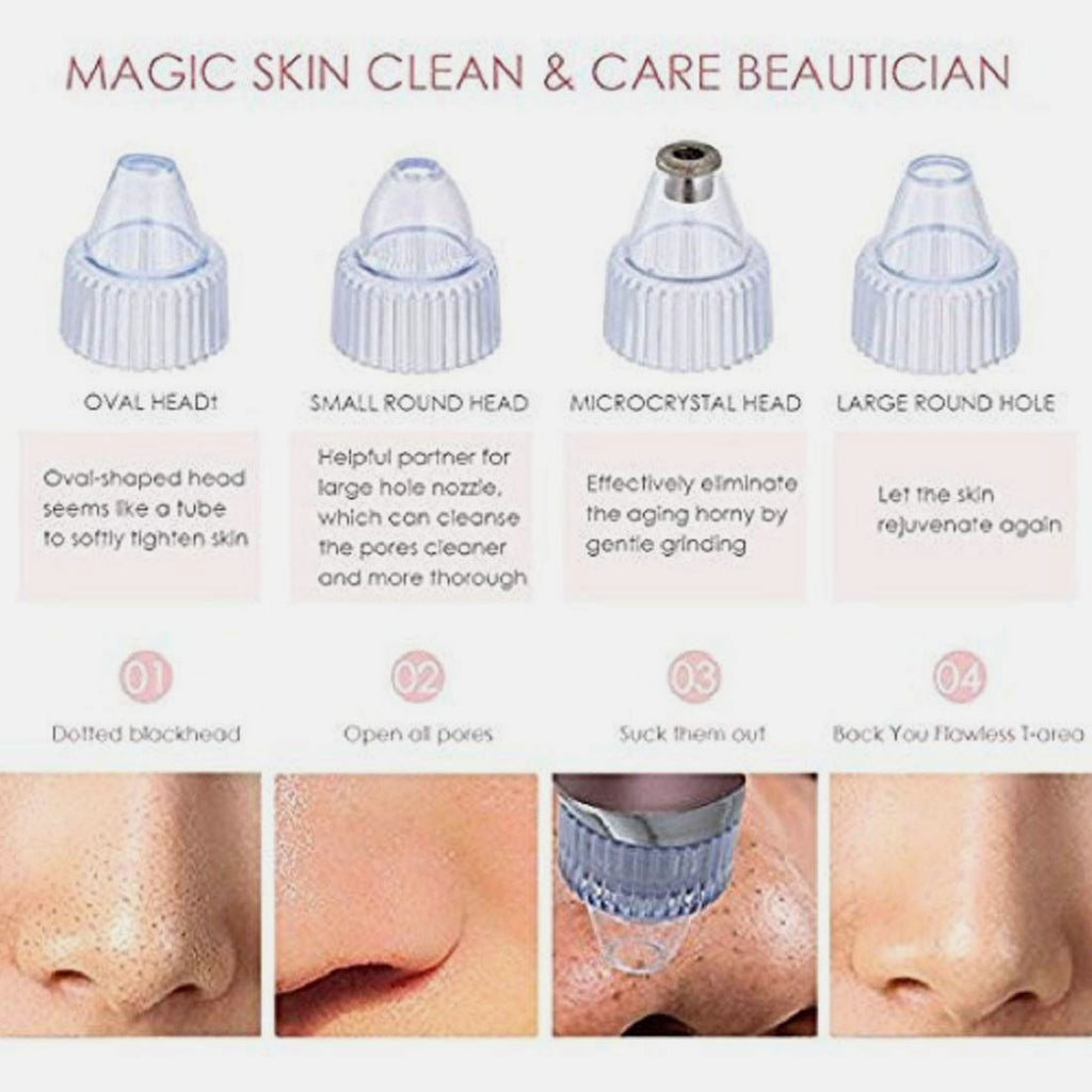 Electric Blackheads Suction Cleanser Vacuum