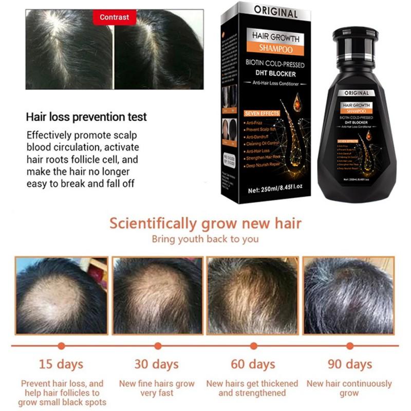 Ginger Hair Growth Hair Thickening Hair Loss Treatments Shampoo 250ml