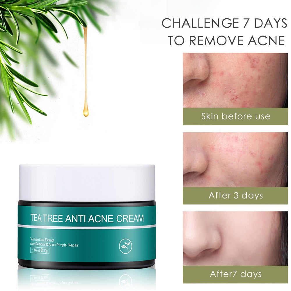 Skin Ever Tea Tree Anti Acne Skin Cream