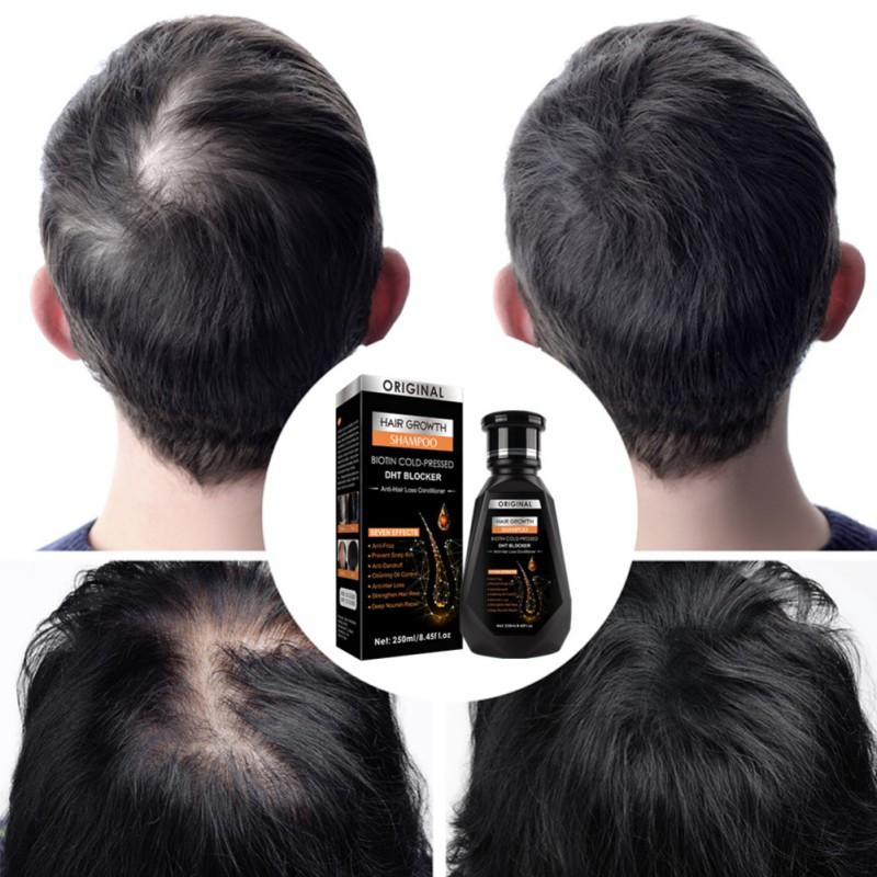 Pei Mei  Ginger Hair Growth Hair Thickening Hair Loss Treatments Shampoo 250ml