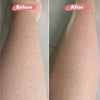 Exfoliating Glove Dead Body Scrubber, Deep Exfoliating Mitt for Body, Stimulates Blood Flow for Youthful Glow