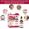Aichun Beauty Medical Formula Remove Scars Whitening Facial Serum
