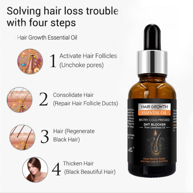 Ginger Hair Growth Hair Thickening Hair Loss Treatments Oil 30ml