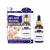 Aichun Beauty Anti-Acne Whitening Facial Serum 30ml