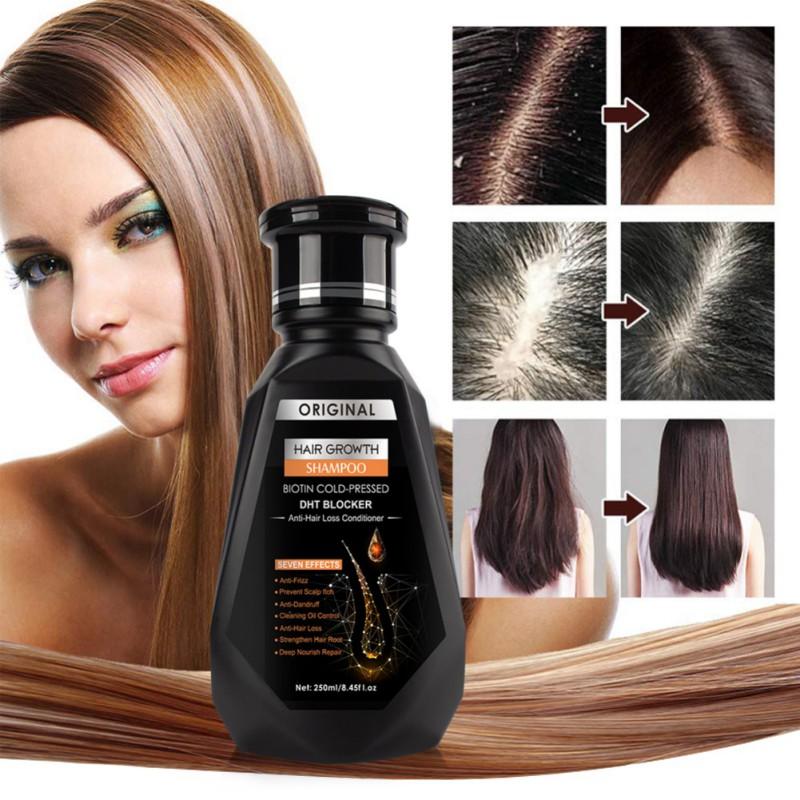 Ginger Hair Growth Hair Thickening Hair Loss Treatments Shampoo 250ml