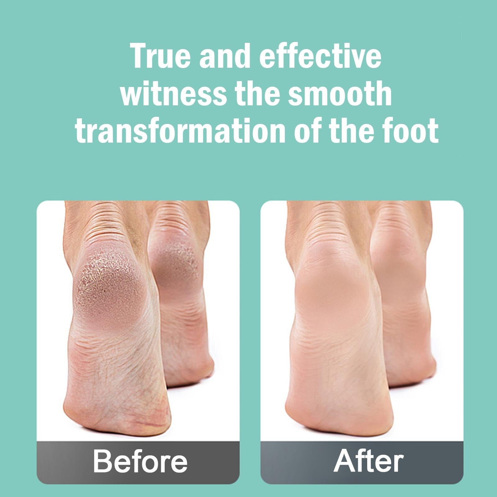 Electric Pedi Callus Remover