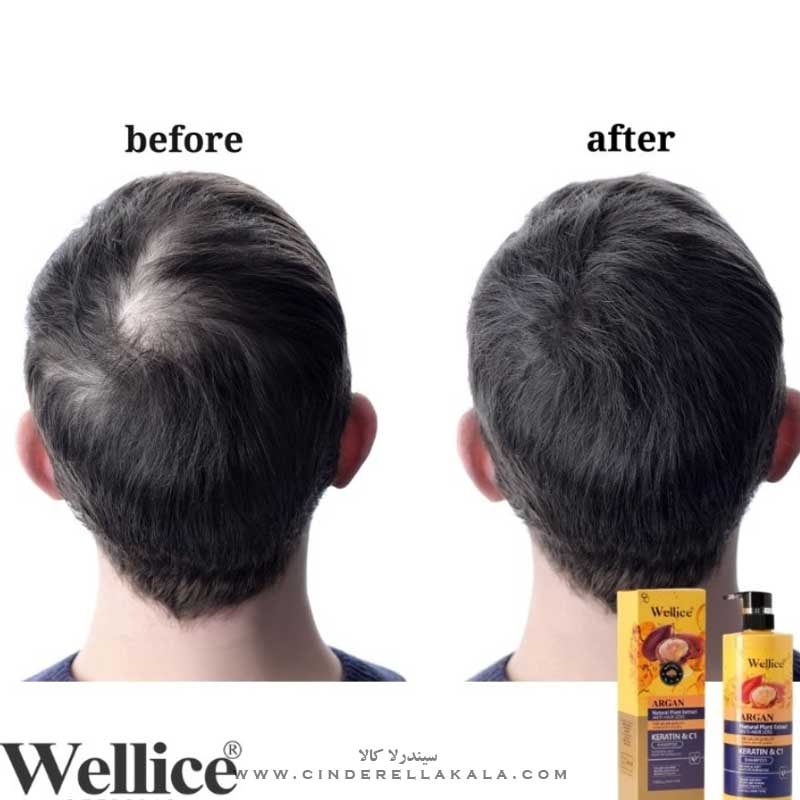 Wellice Argan Natural Plant Extract Anti-Hair Loss Keratin & C1 Shampoo 800ml